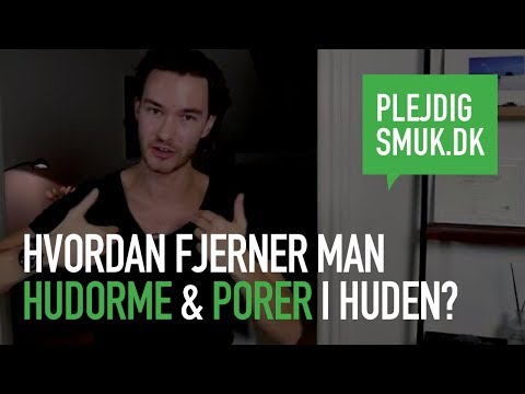 Video: ❶ Hvordan Man Slipper Af Hudorme Og Pletter