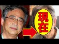 山本正之、今現在(2024)が衝撃的すぎると話題に!