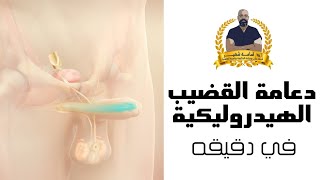 دعامة القضيب الهيدروليكية ـ العلاج الحاسم لضعف الانتصاب بدعامة العضو الذكري كولوبلاست تايتان