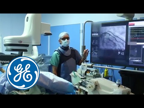 mrid дикий яд ремикс The benefits of using PCI ASSIST in a case with BVS on the LAD