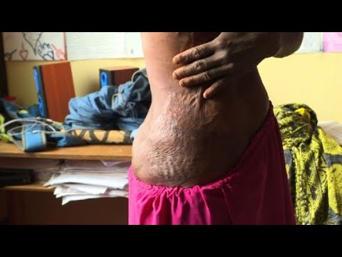 Vídeo: Assassinato Por Feitiçaria Em Papua Nova Guiné - Visão Alternativa