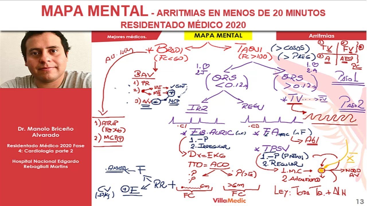 MAPAS MENTALES - ARRITMIAS en menos de 20 minutos - RESIDENTADO MÉDICO 2020