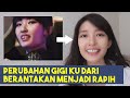 PERUBAHAN GIGI KU DARI BERANTAKAN MENJADI RAPIH, TANPA BEHEL!