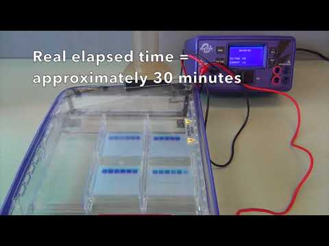 Video: Electrophoresis Para Sa Mga Sanggol: Kalamangan At Kahinaan