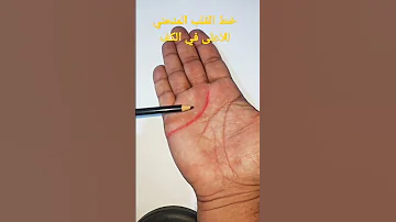 مازن البيضاني خط القلب المنحي للاعلى في الكف 