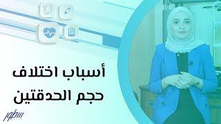 أسباب اختلاف حجم الحدقتين