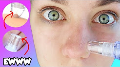 BLACK HEAD PORE VACCUM SUCTION! EWWWW