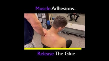 Loosening Muscle Adhesions for Shoulder Relief [Treatment] | Skyline Physical Therapy [Wyckoff, NJ]