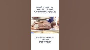 Cutting the human body into sections, sagittal section of female pelvis, anatomy museum #shorts