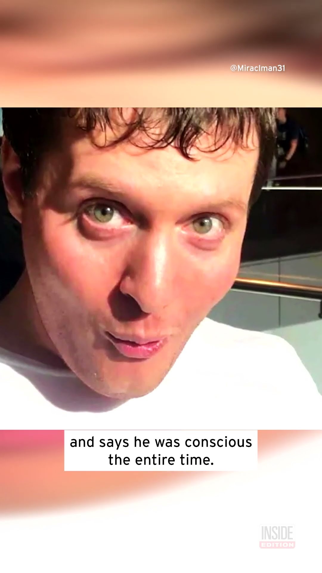 Man Lived in a 'Coma' and Was Conscious the Entire Time #shorts