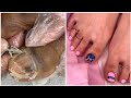 Most Satisfying Pedicure Transformation 😱 best nail polish for toes 2022