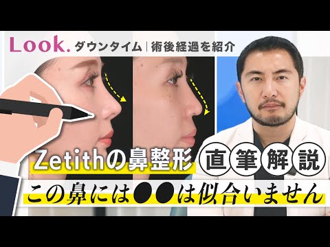 Nose surgery] Create the nose that suits you best
