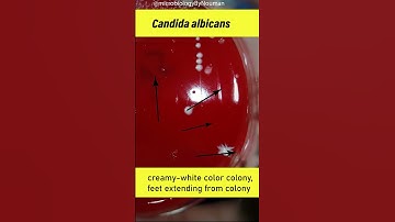 Candida albicans on Blood agar plate #shorts #youtubeshorts