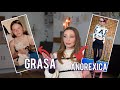 DE LA &quot;GRASA&quot; LA &quot;SLABA&quot; CUM AM INVINS ANOREXIA