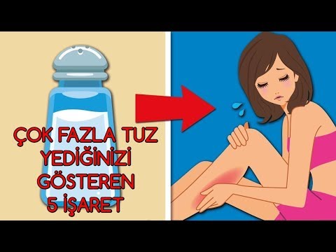 FAZLA TUZ YEDİĞİNİZİ GÖSTEREN 5 İŞARET