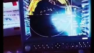 Hondex He 773 Di̇ Taramalı Sonar 2018