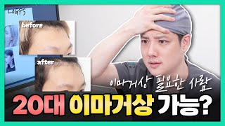 젊은데 이러면 이마거상 필요합니다! | 혹시 내 이마는... #이마거상 #이마