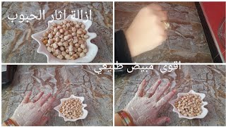 ماسك ازالة اثار الحبوب وتبيض الوجه خطير