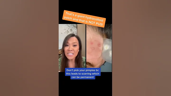 That’s NOT Pus! 💥 | Dr. Pimple Popper #drpimplepopper #pimples #pimplepopping #acne - DayDayNews