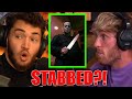 ADIN ROSS WAS STABBED AS A CHILD!
