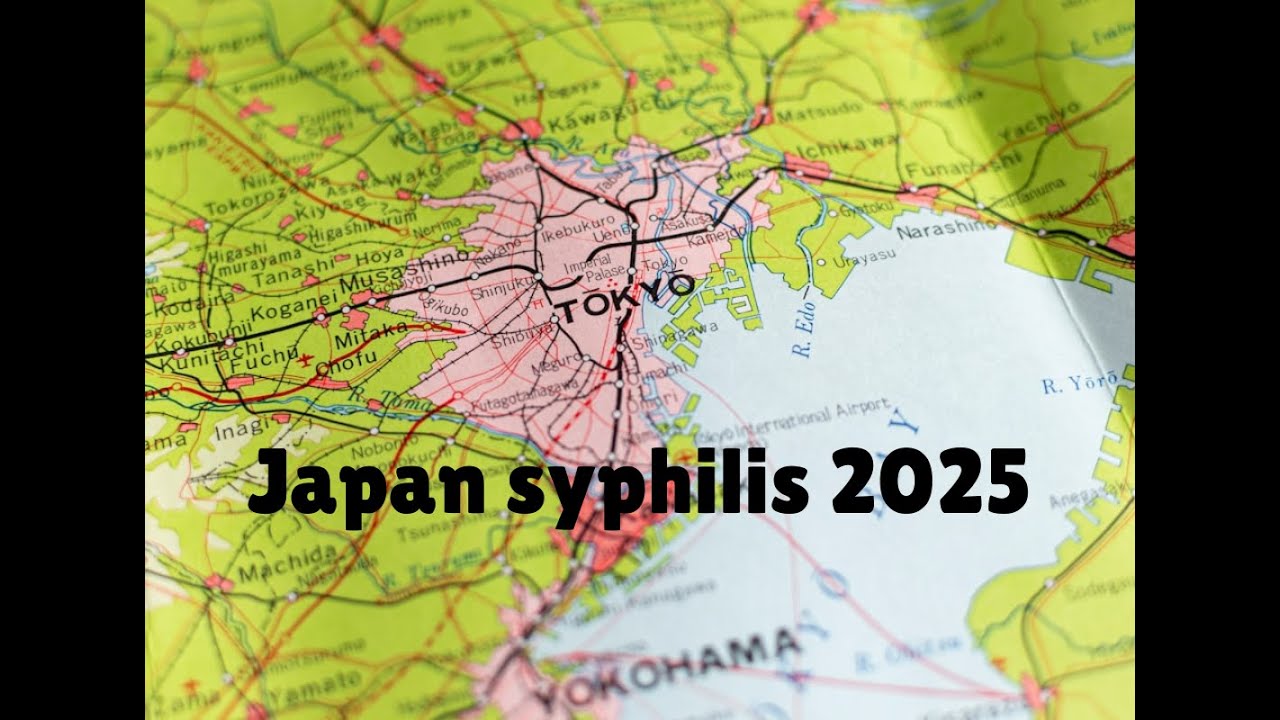 В Японии четвертый год подряд зарегистрировано более 13 000 случаев сифилиса.
