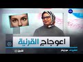 الشروق مورنينغ اعوجاج القرنية و علاقته بضعف الرؤية