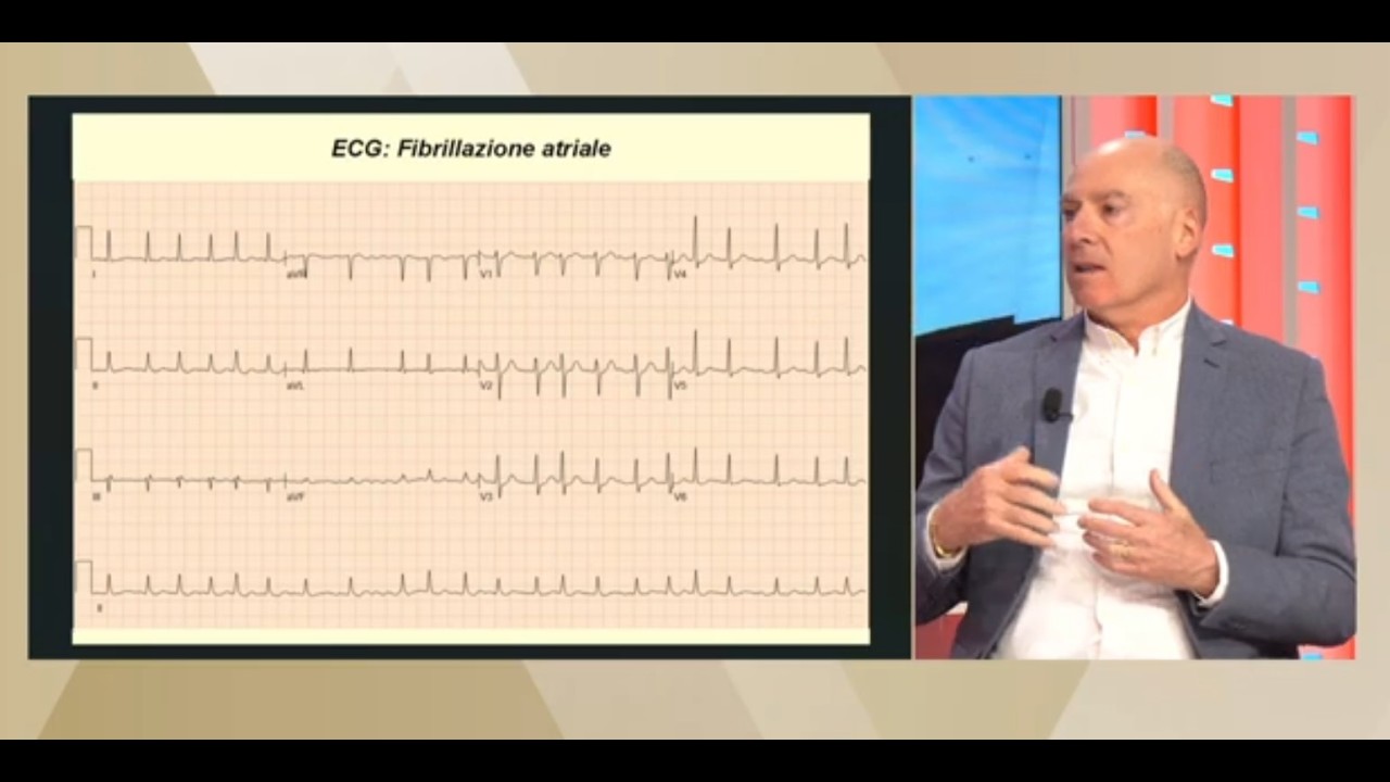 La fibrillazione atriale con il dott. Nicola Bottoni di Villa Verde Reggio Emilia