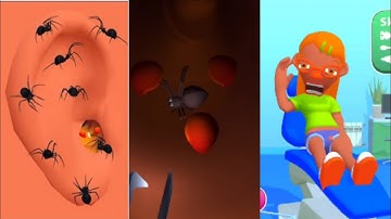 EarWax Clinic Game 3D New Max Level Gameplay Walkthrough Update Trailer iOS, Android Mobile Game