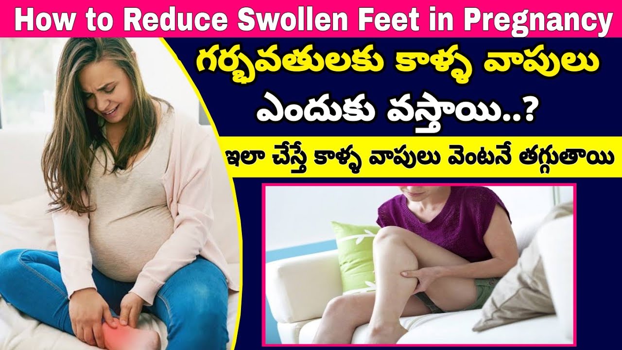 ప్రెగ్నెన్సీ టైంలో కాళ్ల వాపులు How to Reduce Leg Swelling in