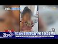 陸3歲女童胖到35kg! 父母拍「餵食影片」賺流量引議｜TVBS新聞 @TVBSNEWS01