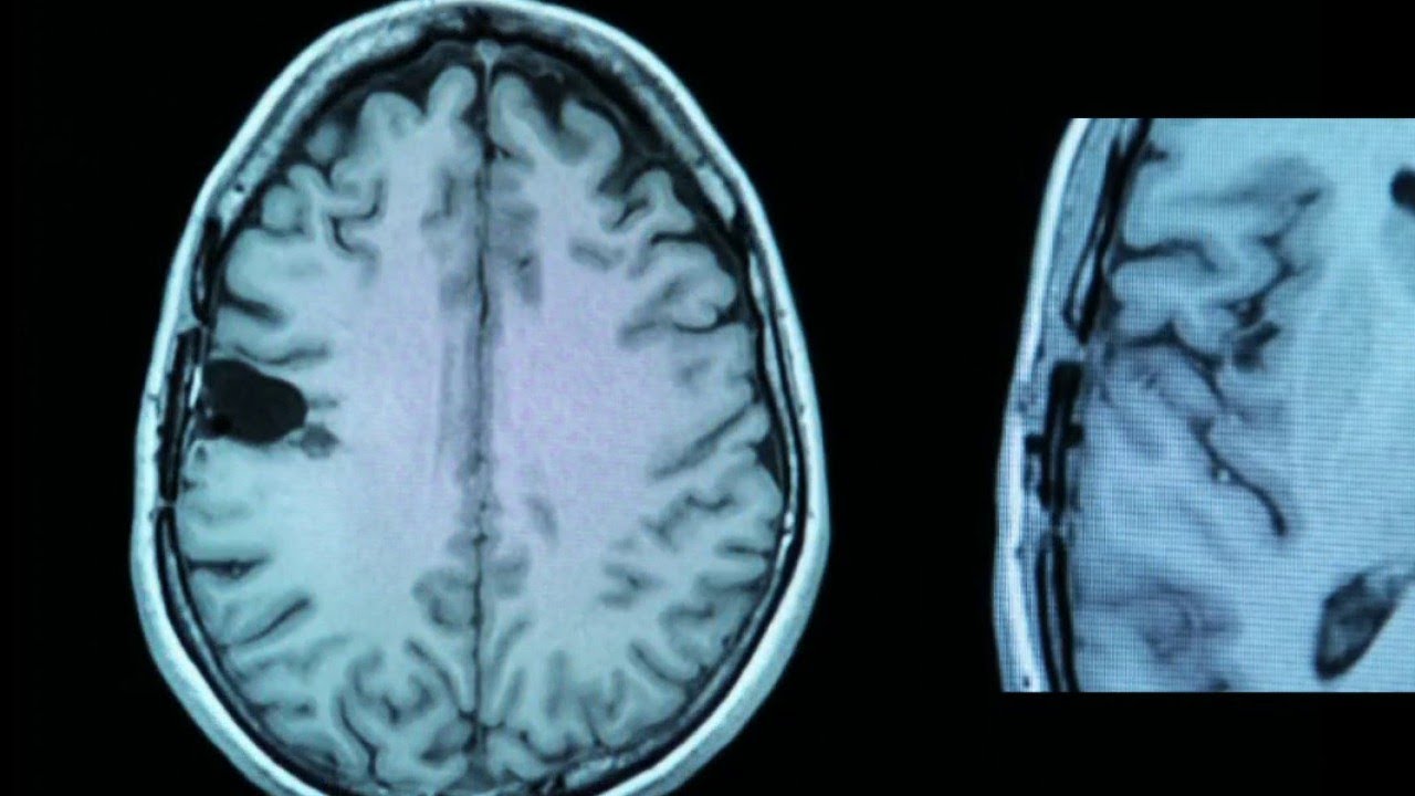 Santé - Merci docteur : il m’a soigné de l’épilepsie