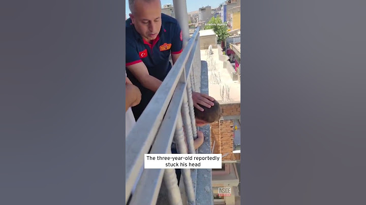 Child Freed After He Gets Head Stuck in Railings #shorts