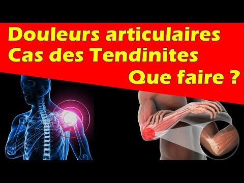 Articulations : Douleurs et Tendinites - Que faire ?