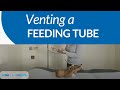How to vent a feeding tube