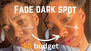 How to get rid of dark spot on dark skin |crazy result 