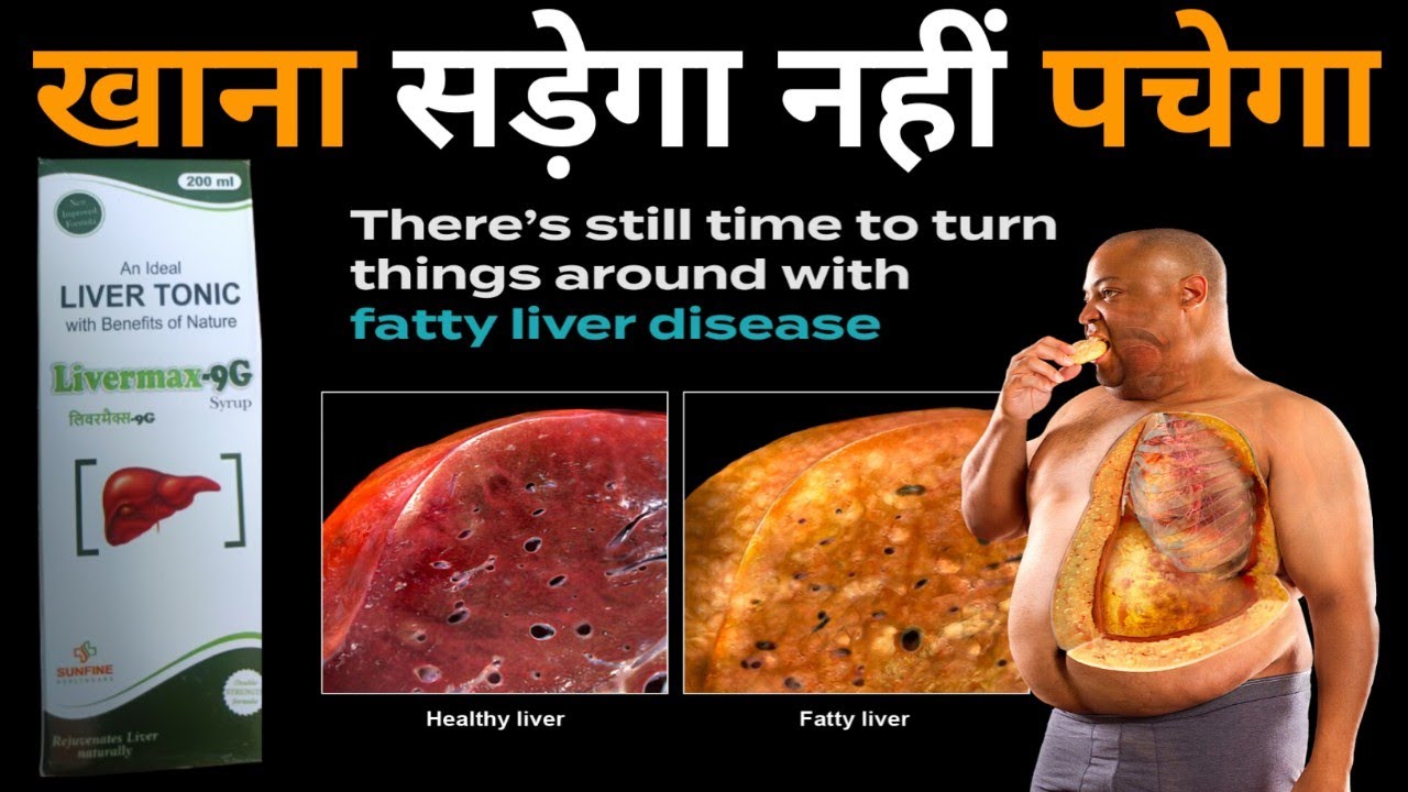 Livermax-9G syrup review in Hindi  भूख की कमी, खून की कमी, पिलाया को ठीक करे @drxmohdaadil