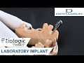 The titanium laboratory implant for digital and conventional fabrication methods