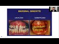 Pathology Lecture - Diseases of Gingiva, Periodontium, Salivary glands, and Jaw