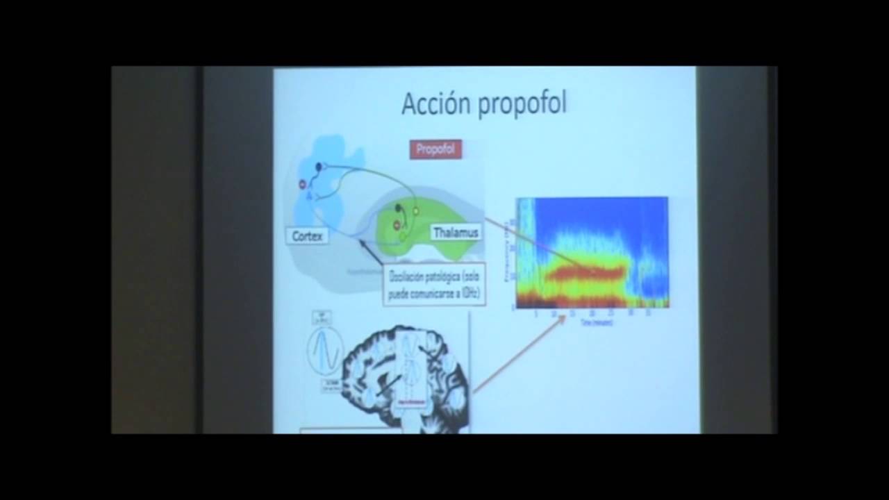 Nuevas técnicas de monitorización cerebral.‏