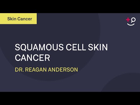 What is Squamous Cell Cancer? - Squamous Cell Cancer Explained [2019] [Dermatology]
