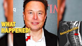 Elon Musk Failed Surgery on his Neck - What Happened? screenshot 3