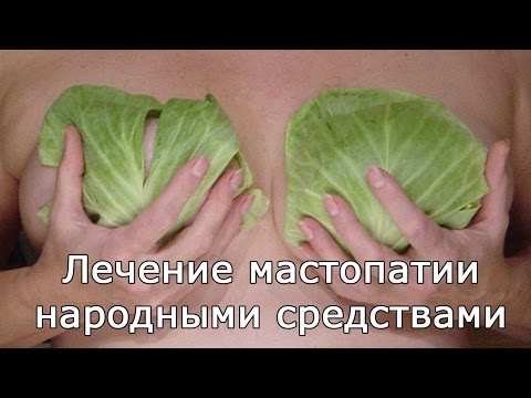 Лечение мастопатии народными средствами Лечение мастопатии народными средствами
