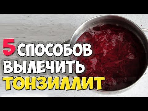 Как вылечить хронический тонзиллит народными средствами