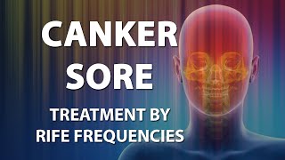 Canker Sore - RIFE Frequencies Treatment - Energy & Quantum Medicine with Bioresonance