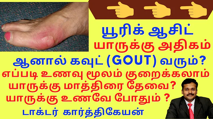 uric acid foods to avoid symptoms treatment to reduce gout attack in tamil | dr karthikeyan | கவுட் - DayDayNews
