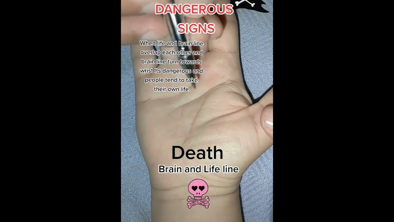Dangerous Signs On Hand Palmist Palmistry Palmistry001