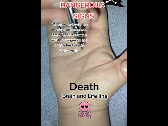 Dangerous signs on hand#palmist #palmistry #palmistry001 class=