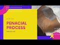 Penacial Process | Vajacial For Men