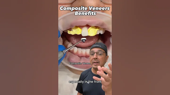Composite Bonding (Veneers) Explained | In Office to Hands On Dental Training #shorts
