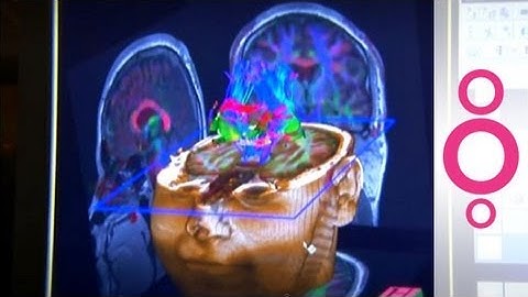 What is brain plasticity? - do you know?